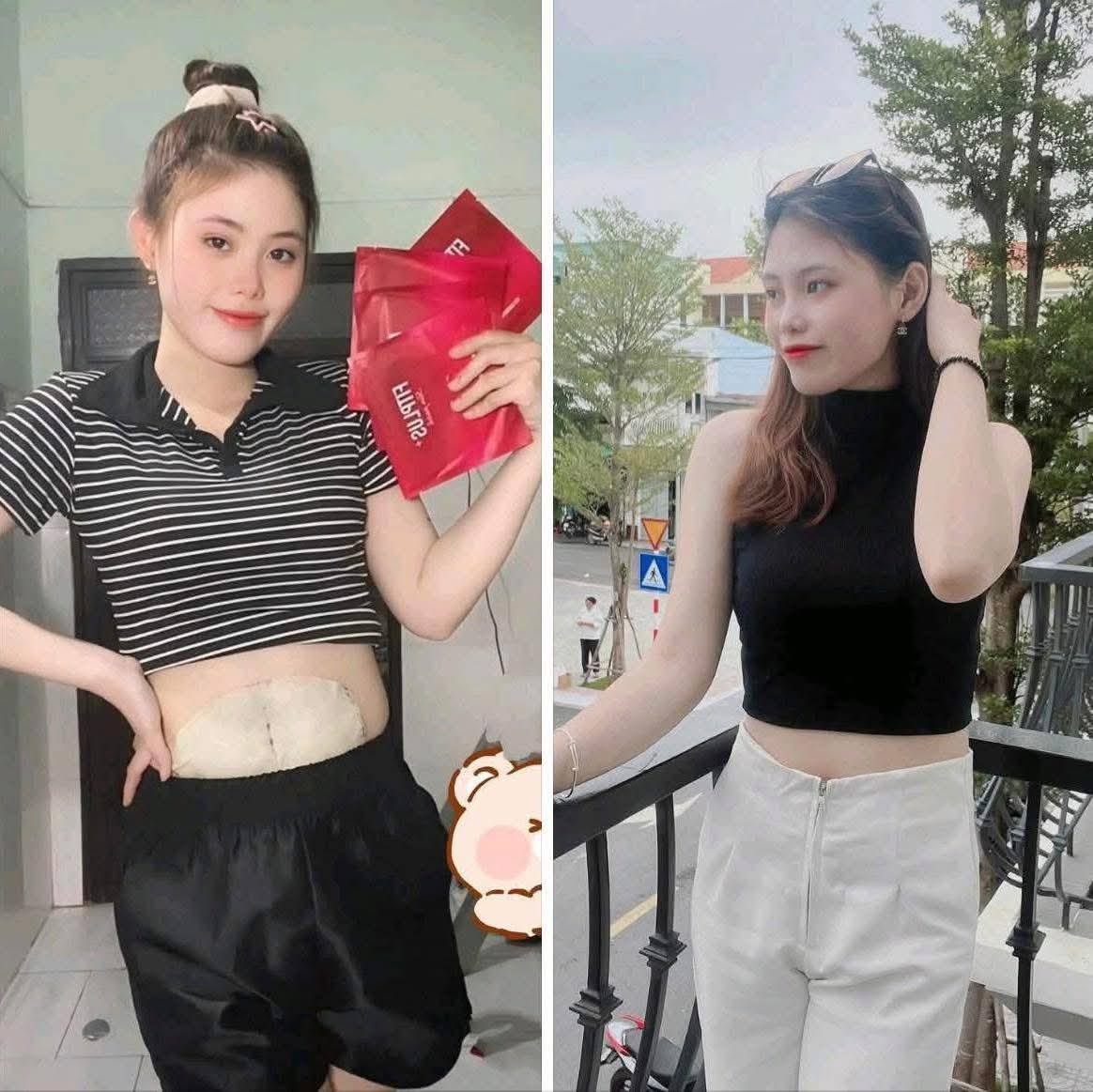 Cao dán tan mỡ Fitplus